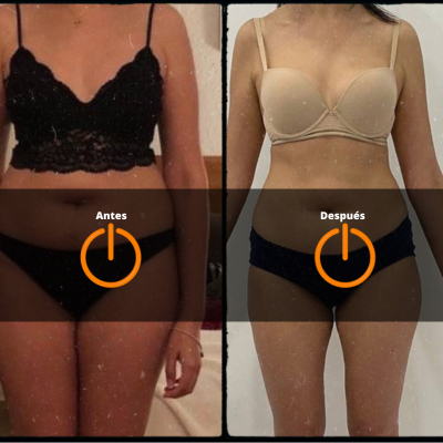 Antes-Despues